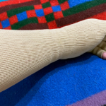lymphedema arm